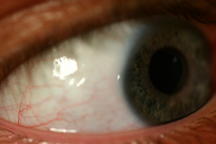 eye_07585.jpg