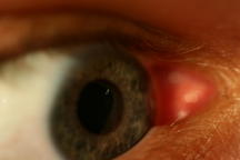 eye_07586.jpg